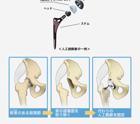 你们知道申花球迷那个最骚的是什么吗
